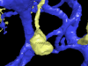 Synapse Discovered in EyeWire
