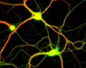 synapses synapses