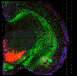 CLARITY GIF IOTBS 1 EyeWire CLARITY GIF IOTBS 1 EyeWire