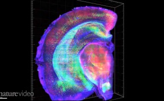 CLARITY makes brains clear Nature eyewire CLARITY makes brains clear Nature eyewire