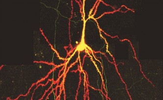 wo-photon microscopy image of a neuron published in PNAS by Holbro N et al. (2009), neuron,